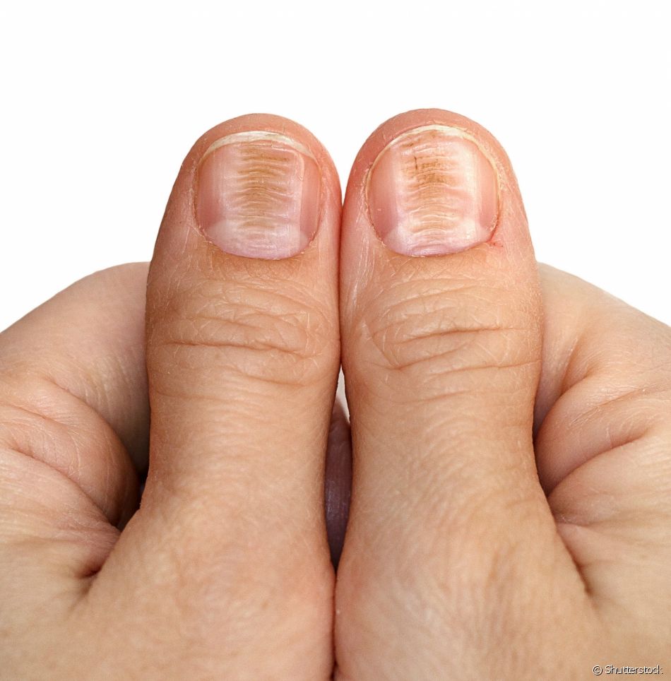 Foto: Shutterstock