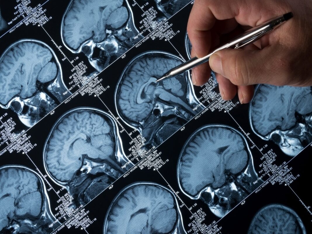 Imagem: iStock